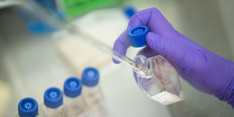 In a cancer lab, a close-up of a hand wearing a purple glove using a pipette.
